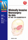 Minimally Invasive Neurosurgery: Up date