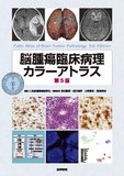 脳腫瘍臨床病理カラーアトラス 第5版