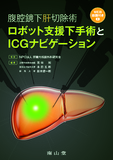 腹腔鏡下肝切除術　ロボット支援下手術とICGナビゲーション