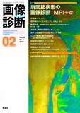 画像診断 Vol.33 No.2