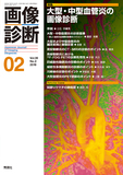画像診断 Vol.39 No.2（2019年2月号）