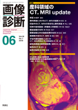 画像診断 Vol.39 No.7（2019年6月号）