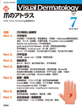 VisualDermatology Vol.21 No.7（2022年7月号）
