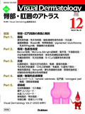 VisualDermatology Vol.21 No.12（2022年12月号）
