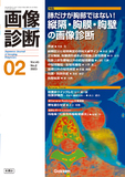 画像診断 Vol.43 No.2（2023年2月号）