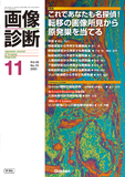 画像診断 Vol.43 No.13（2023年11月号）