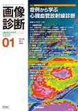 画像診断 Vol.44 No.1（2024年1月号）