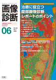 画像診断 Vol.44 No.7（2024年6月号）