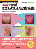 Visual Dermatology 2024年臨時増刊号
