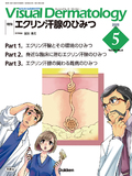 VisualDermatology Vol.24 No.5（2025年5月号）