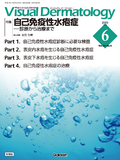 VisualDermatology Vol.24 No.6（2025年6月号）