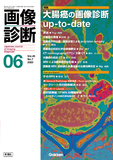 画像診断 Vol.45 No.7（2025年6月号）