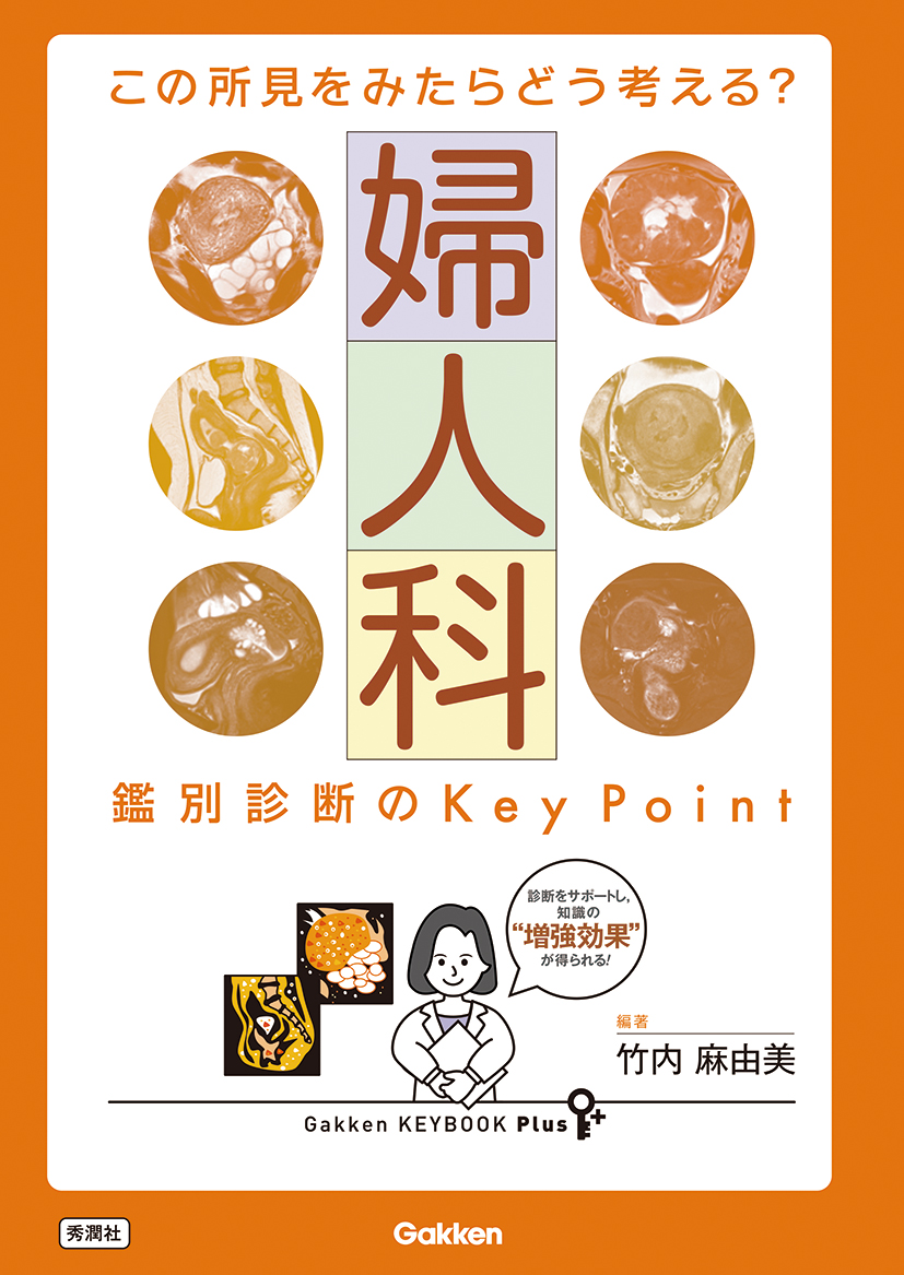 この所見をみたらどう考える？　婦人科　鑑別診断のＫｅｙ　Ｐｏｉｎｔ