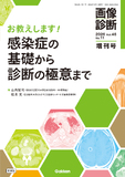 画像診断 Vol.46 No.11（2026年増刊号）