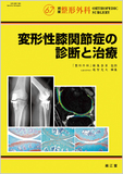 別冊整形外科 No.67 変形性膝関節症の診断と治療