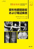 別冊整形外科 No.42 変形性膝関節症および周辺疾患