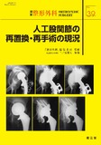 別冊整形外科 No.39 人工股関節の再置換・再手術の現況