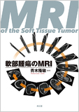 軟部腫瘍のMRI