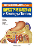腹腔鏡下結腸癌手術のStrategy & Tactics