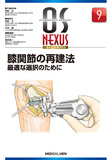 膝関節の再建法