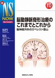 脳動静脈奇形治療のこれまでとこれから