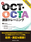 新OCT・OCTA読影トレーニング 改訂第2版