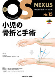 小児の骨折と手術［Web動画付］