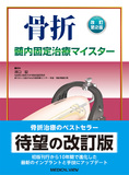 骨折　髄内固定治療マイスター 改訂第2版