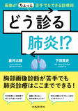 どう診る肺炎!?　画像が（ちょっと）苦手でもできる診療術