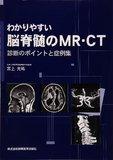 わかりやすい脳脊髄のMR・CT