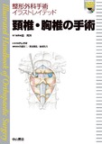 頚椎・胸椎の手術【動画付き】