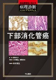 下部消化管癌
