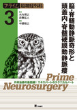プライム脳神経外科３　脳・脊髄動静脈奇形と頭蓋内・脊髄硬膜動静脈瘻