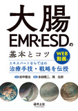 大腸EMR・ESDの基本とコツ