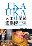 TKA・UKA　人工膝関節置換術パーフェクト
