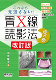 これなら見逃さない！胃X線読影法　虎の巻　改訂版