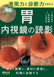 表現力と診断力を高める　胃内視鏡の読影