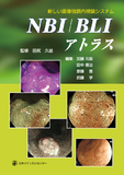 新しい画像強調内視鏡システム　NBI/BLIアトラス
