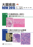大腸疾患ＮＯＷ　2015  《大腸癌取扱い規約》第8版改訂のポイント／大腸の神経内分泌腫瘍