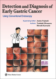 Detection and Diagnosis of Early Gastric Cancer
