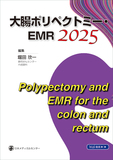 大腸ポリペクトミー・EMR 2025