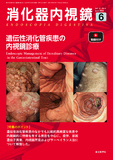 消化器内視鏡37巻6号