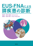 EUS-FNAによる膵疾患の診断