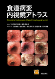食道病変内視鏡アトラス