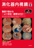 消化器内視鏡38巻8号（26年8月号）