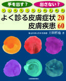 手を出す？出さない？　ジェネラリストのためのよく診る皮膚症状20／皮膚疾患60