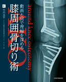 動画と図で理解を深める　膝周囲骨切り術（AKO)