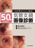 50症例から学ぶ！これが見えたらこう診る！気管支鏡画像診断