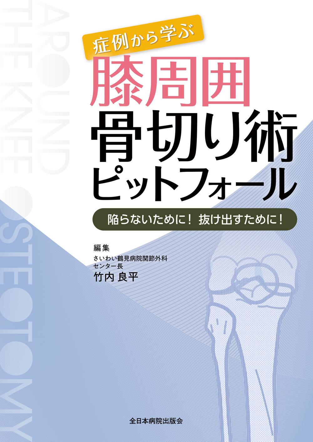 症例から学ぶ膝周囲骨切り術ピットフォールー陥らないために！ 抜け出すために！ー