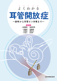 よくわかる耳管開放症―診断から耳管ピン手術まで―